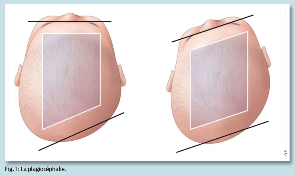 Kinéactualité de Février 2017
